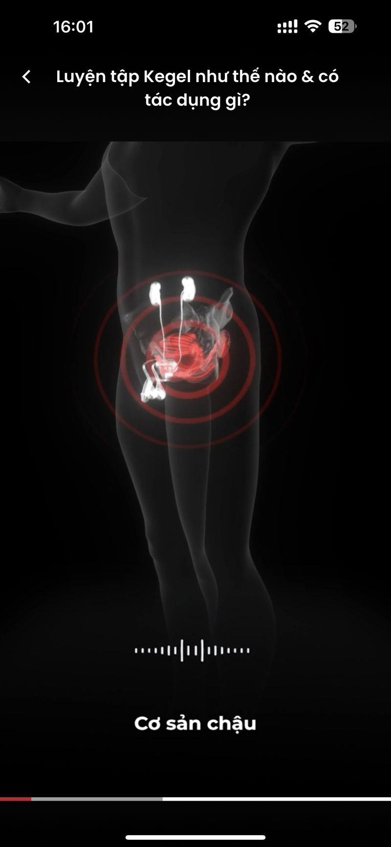 Pelvic floor diagram